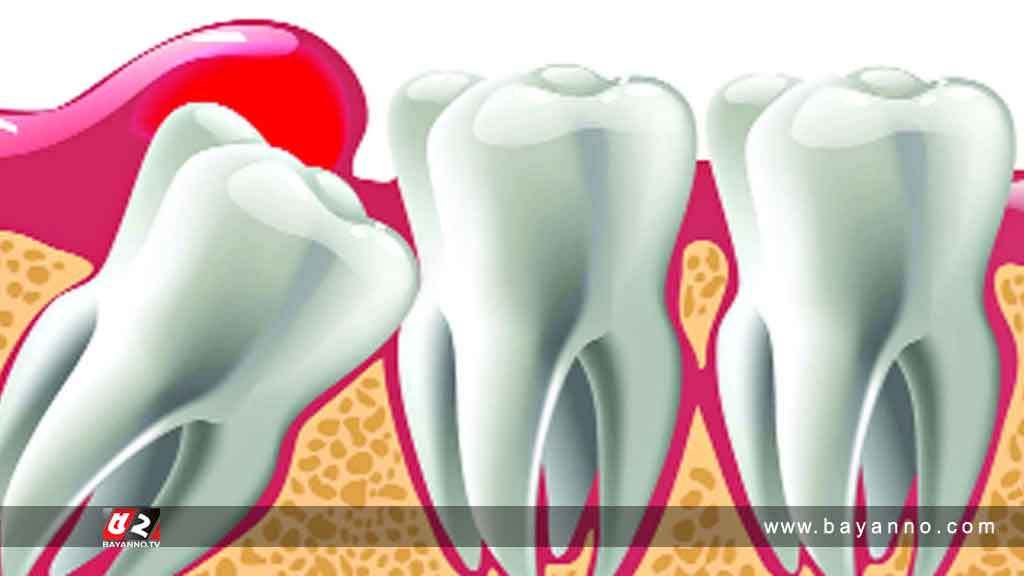 ডেন্টালে ভর্তির আবেদন শুরু, চলবে ৩ ফেব্রুয়ারি পর্যন্ত